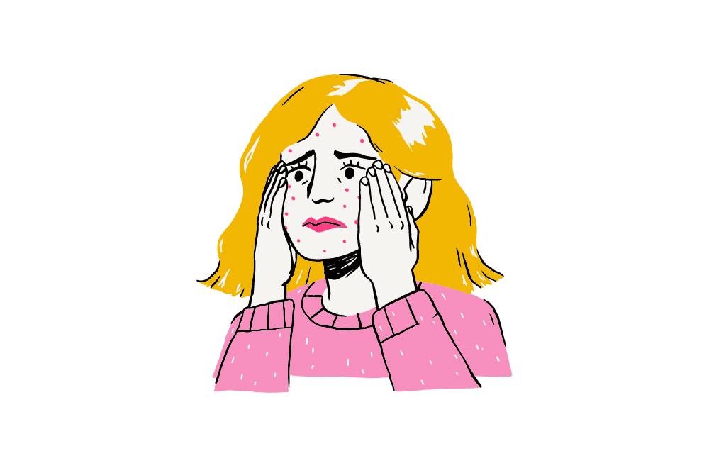 polycystic ovarian syndrome, skin tags, severe acne