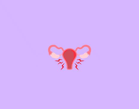 Understanding Pelvic Inflammatory Disease (PID): Causes, Symptoms, and Treatment
