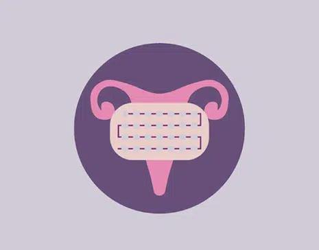 8 Things to Know Before Starting the Pill